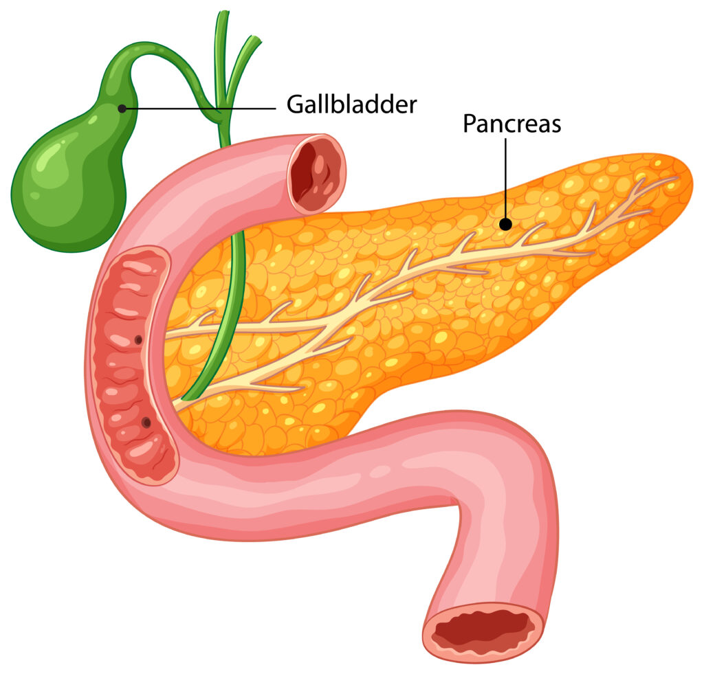 Can Gallbladder Issues Cause Weight Gain