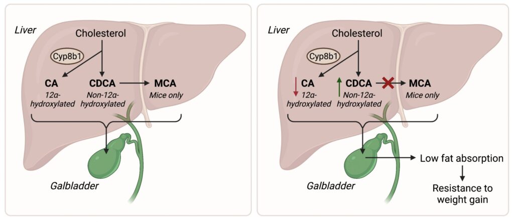 Gallbladder Weight Gain